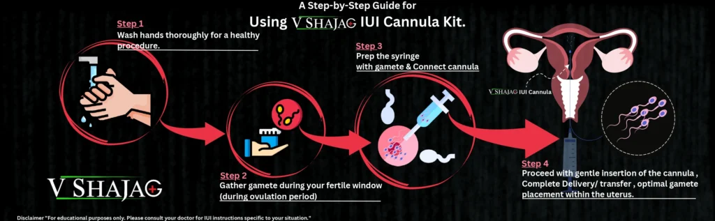IUI cannula kit